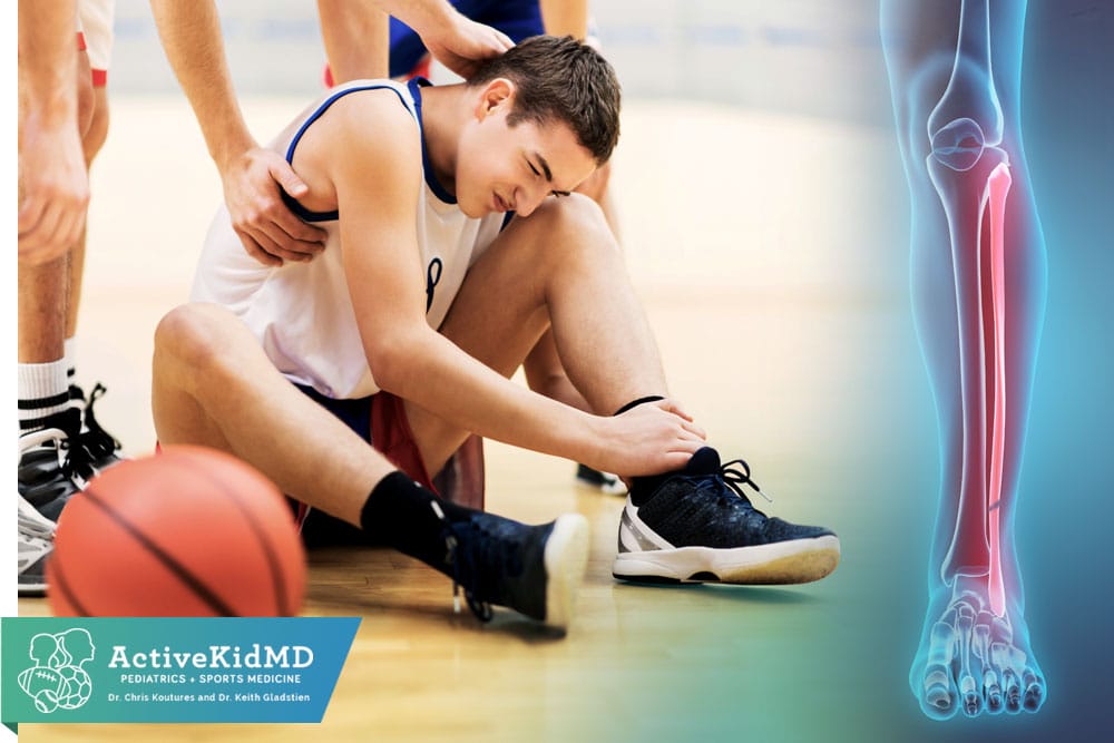 Bone Stress Injuries