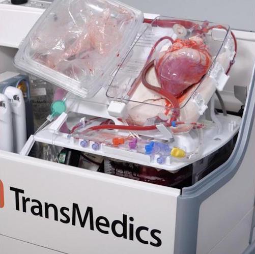 Künstliche Herzdruckmassage in einem TransMedics Herz-Lungen-Perfusionsgerät, medizinische Geräte für Transplantationen und Herzoperationen, innovative Herztechnik, lebensrettende Herzmedizin, TransMedics Technologies.