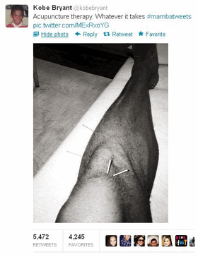 Acupuncture for Basketball Injuries