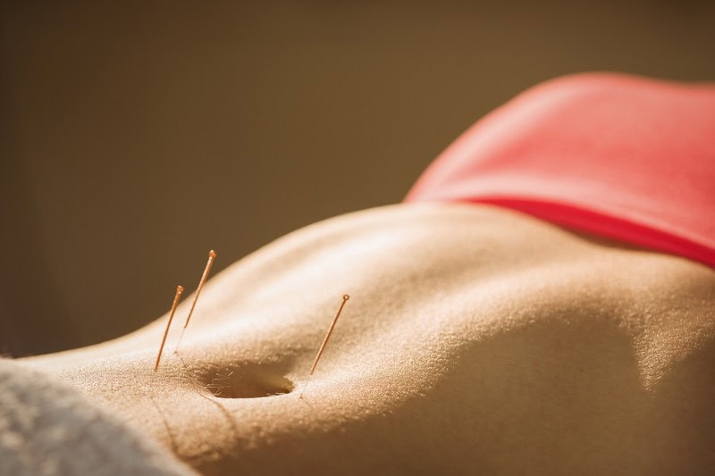 Acupuncuture for Women