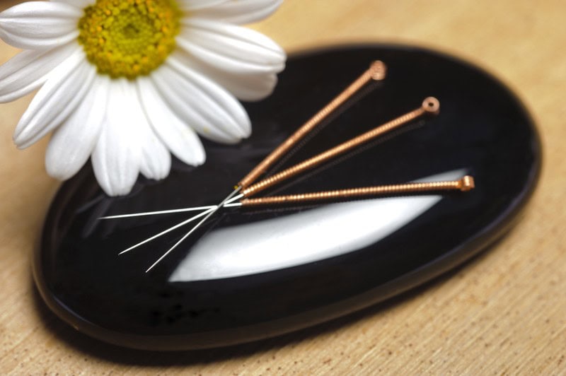 Acupuncture for Endometriosis