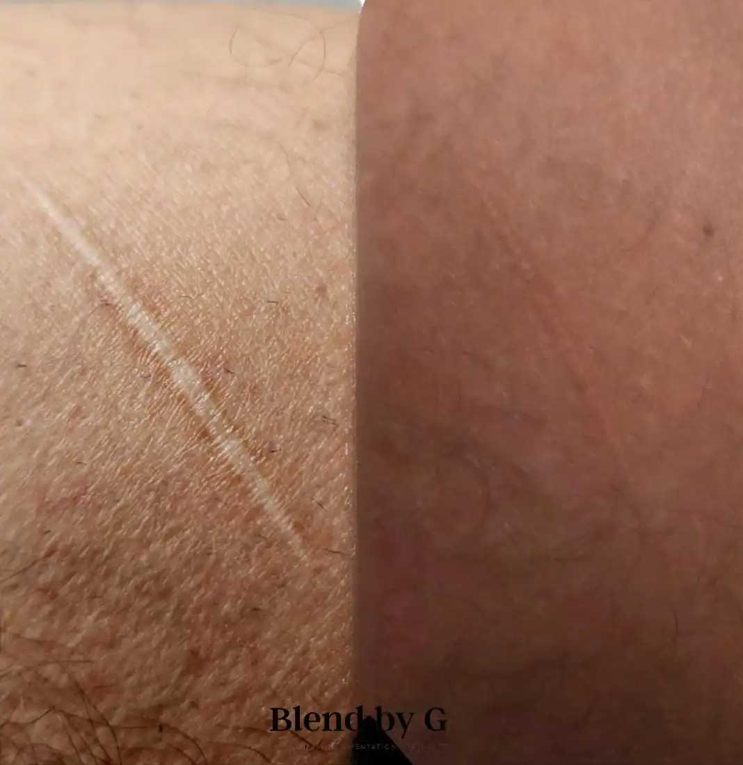 Close-up of skin with scar before and after treatment at Blend by G.