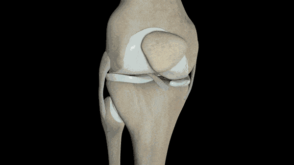 Lesión de ligamento
