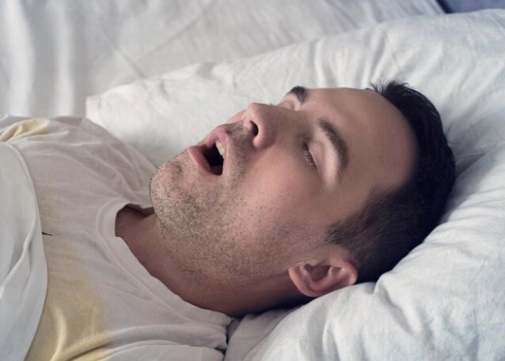 Mouth Breathing