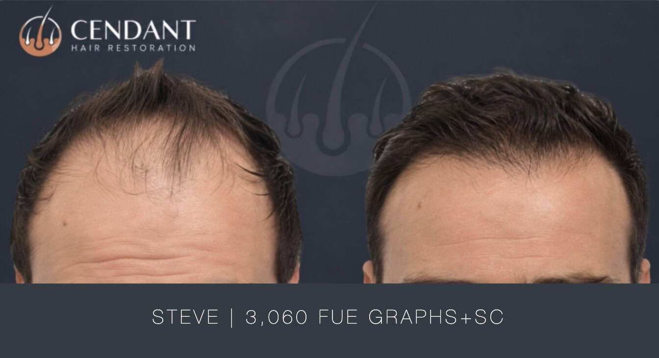Steve 3,060 FUE Graphs+SC