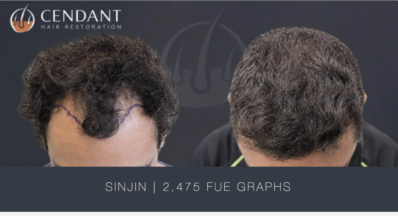 Sinjin 2,475 FUE Graphs