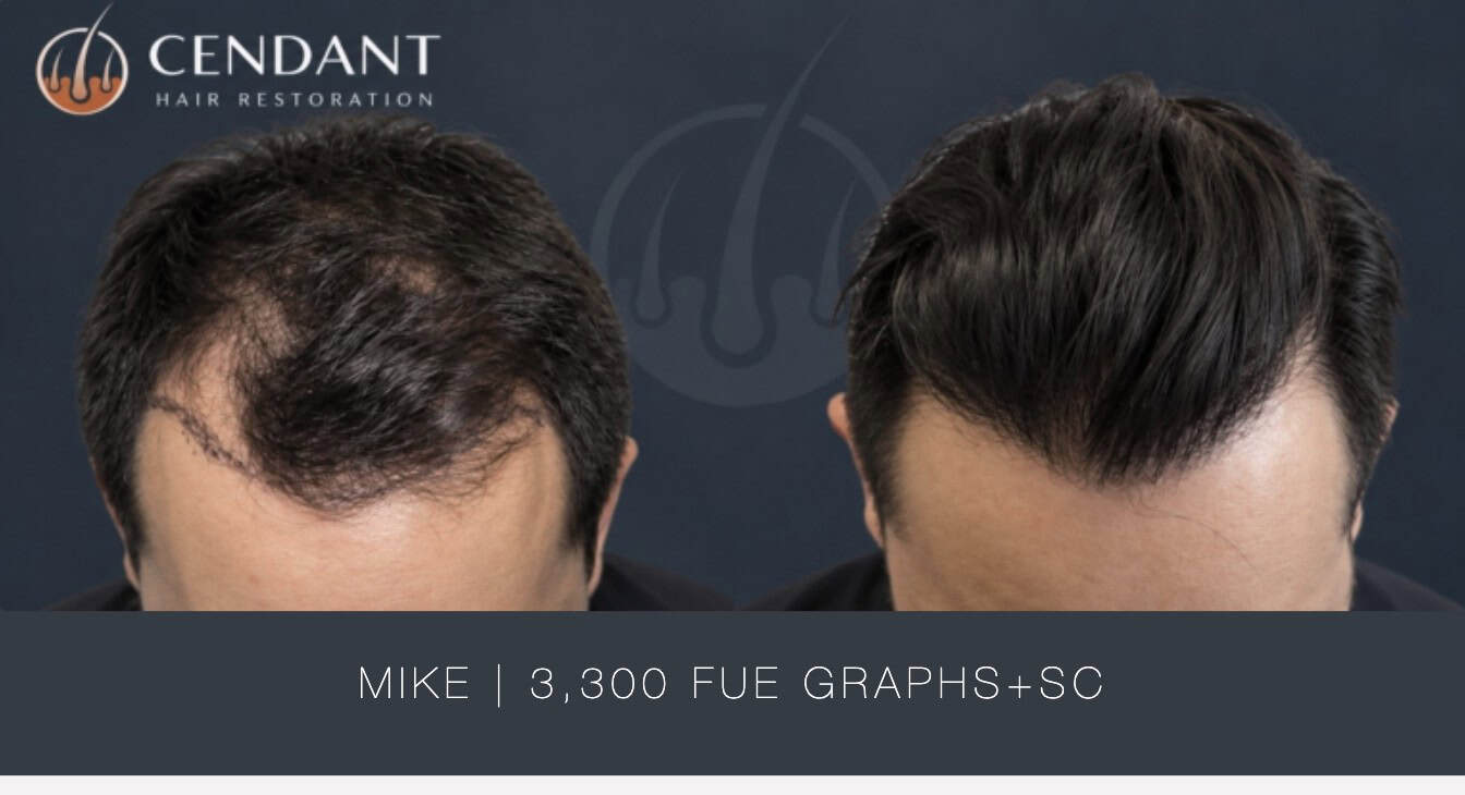 Mike 3,300 FUE Graphs+SC