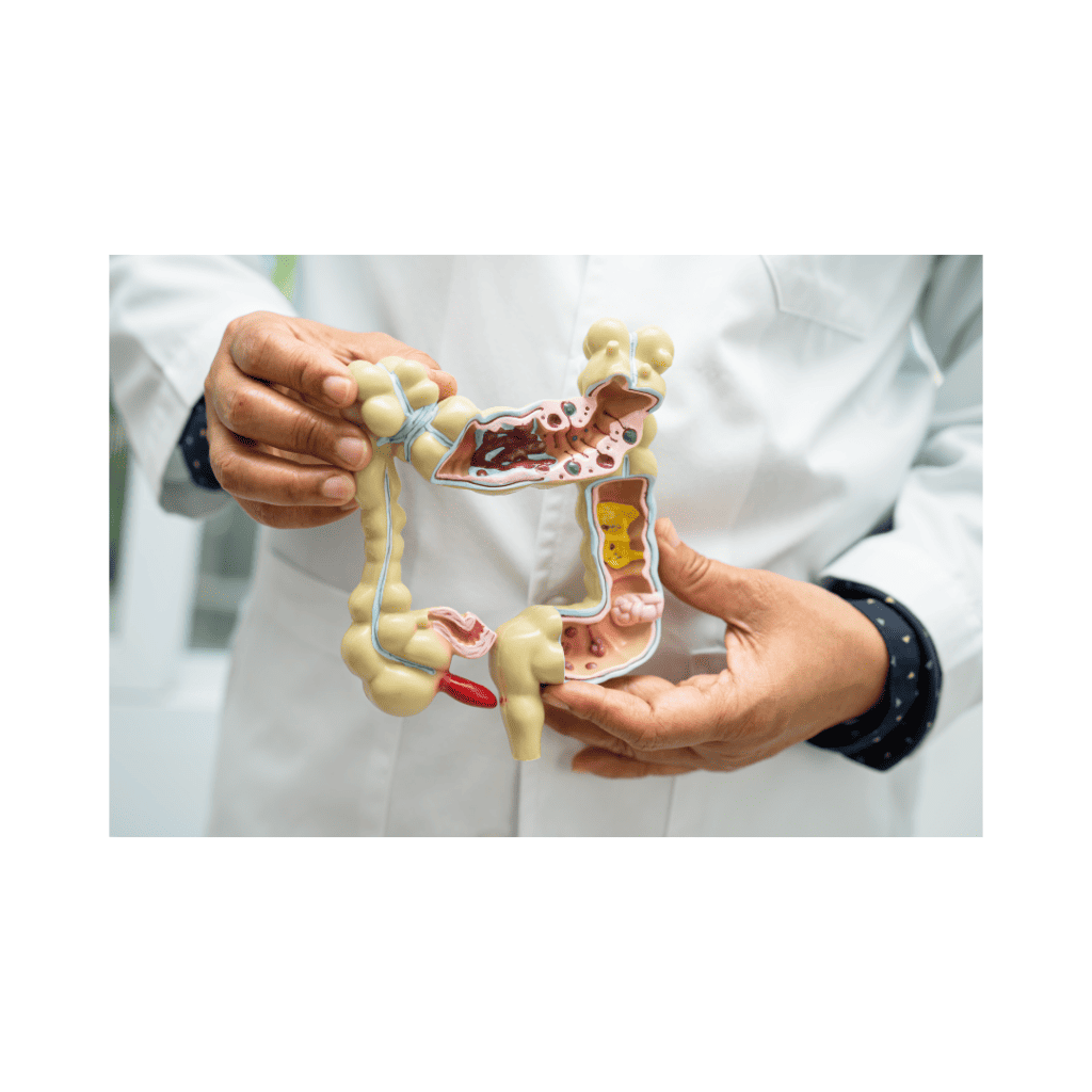 Healthcare professional in a white coat holding an anatomical model of the human large intestine and digestive system