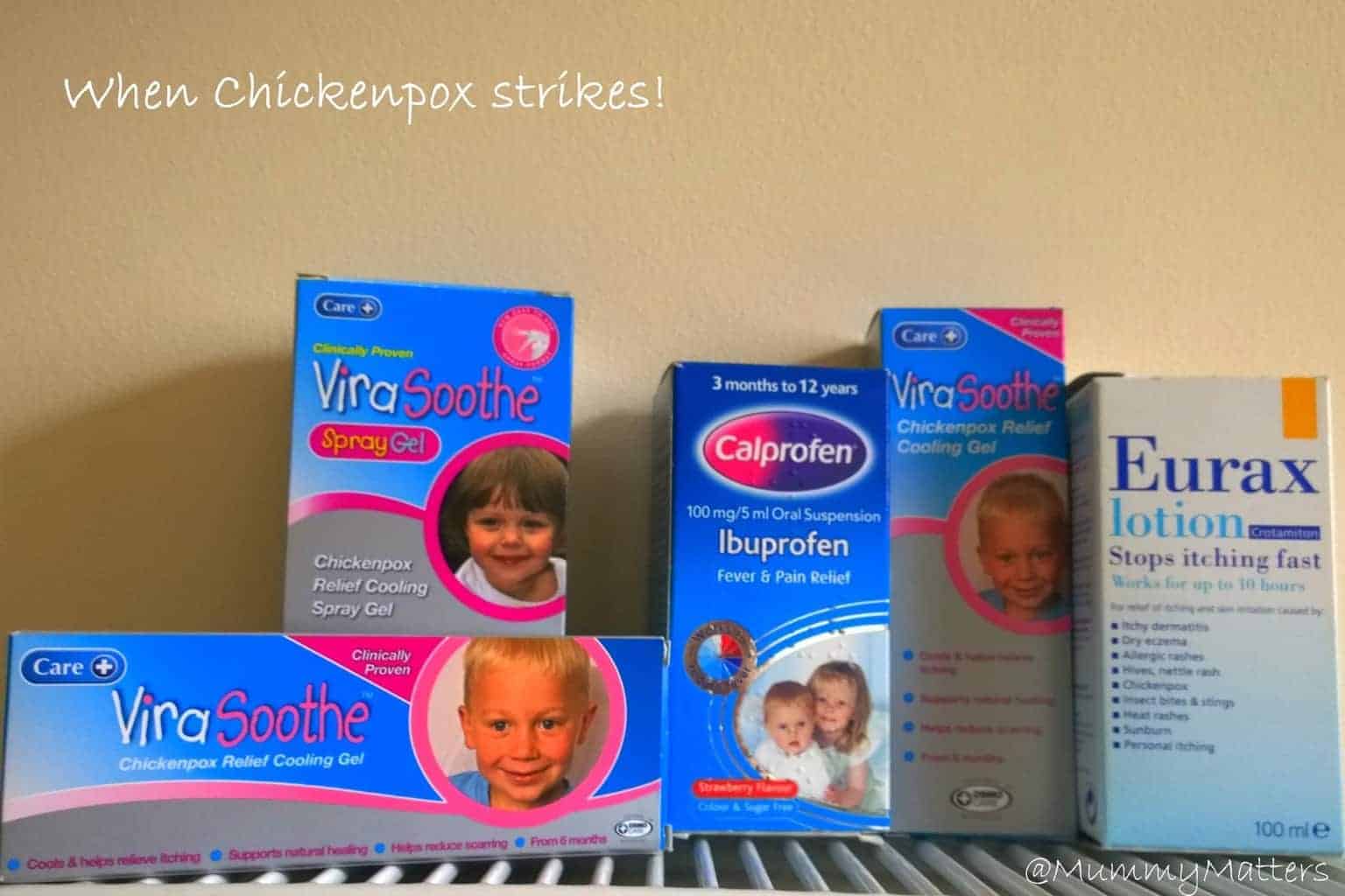 Chickenpox