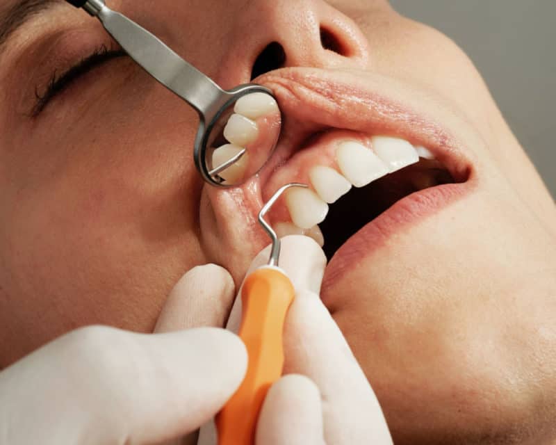 How to Select Your Dentist?