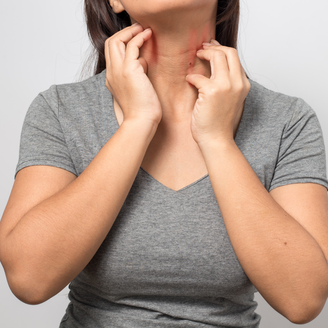 itchy skin