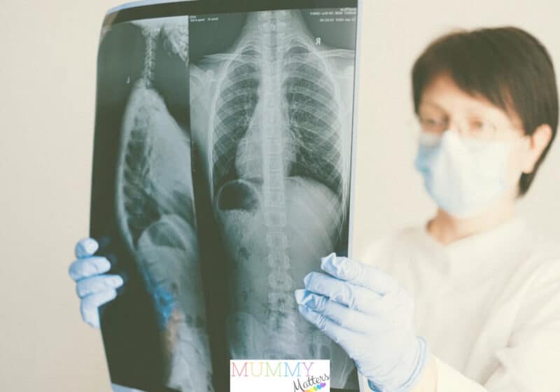 Reduce the Risk of Lung Diseases Reduce the risk of lung diseases