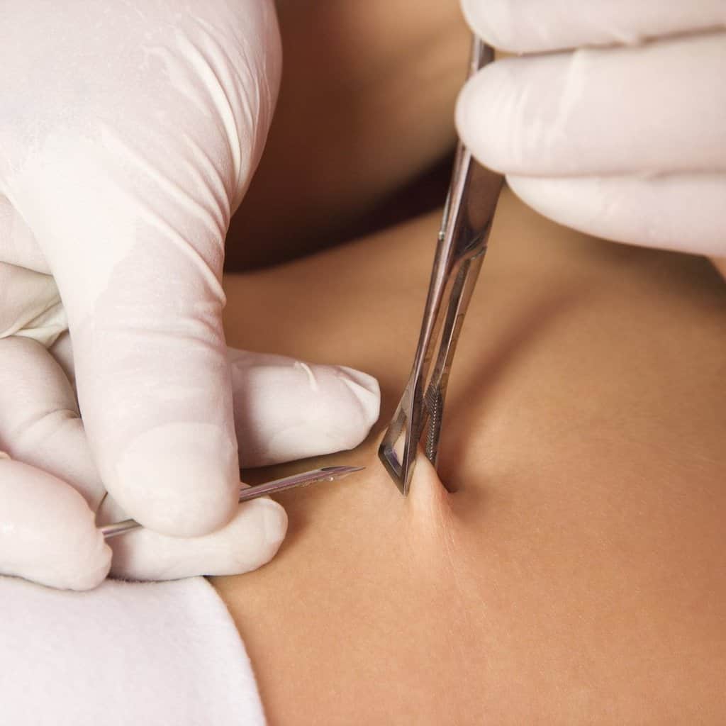 Body piercing