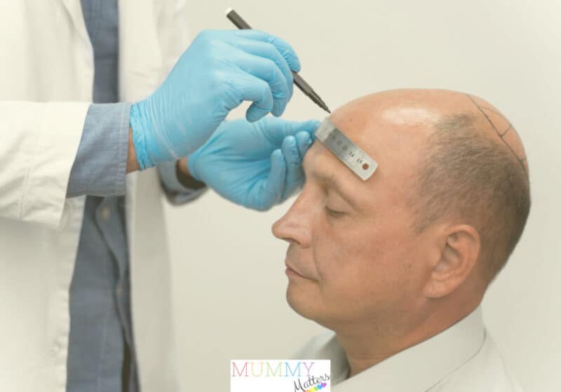 Hair transplantation