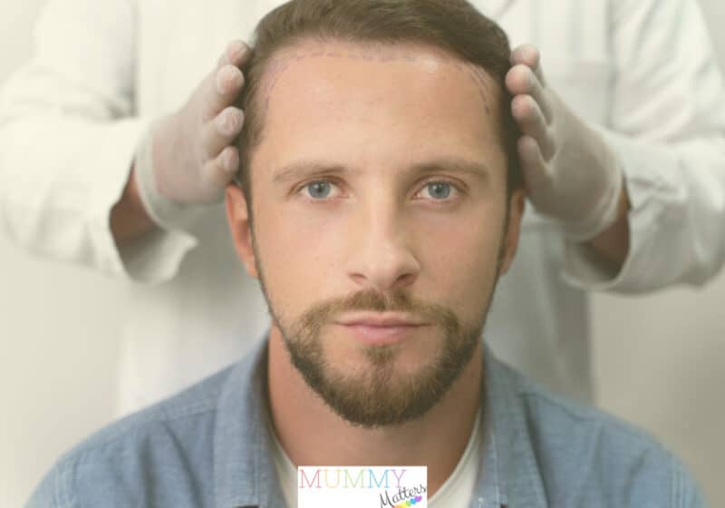 Hair transplantation