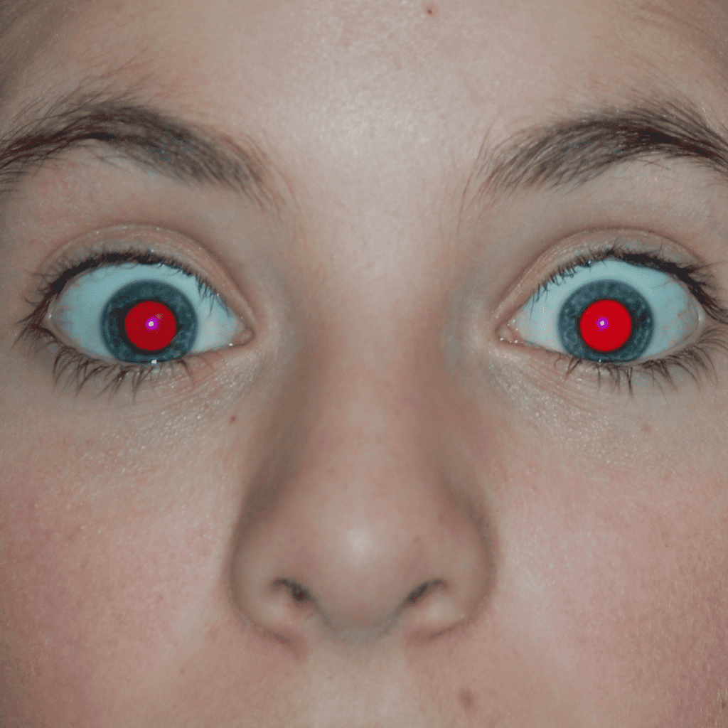 red eye