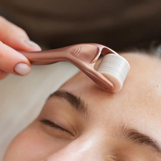 RF Microneedling