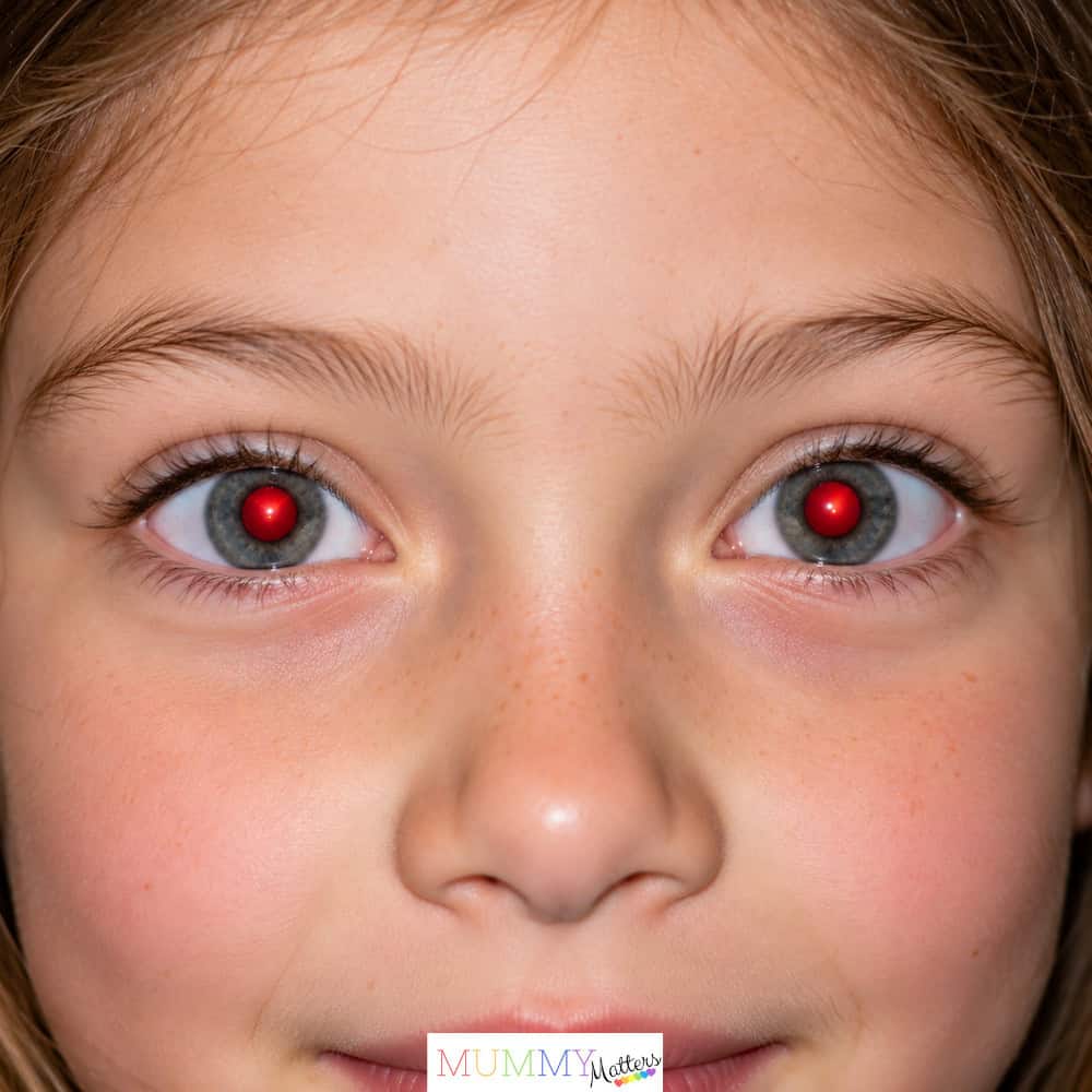 Close-up of a child's eyes showing the red-eye effect caused by camera flash