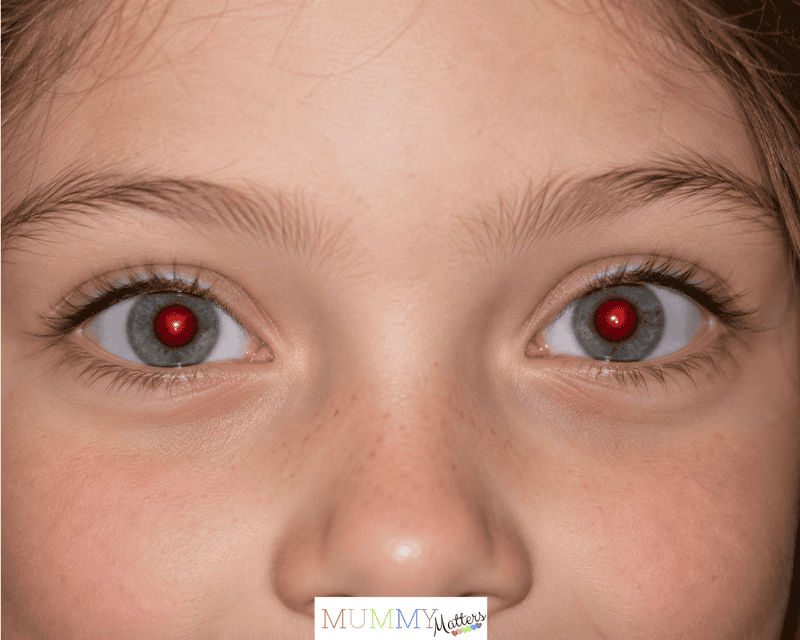 Close-up of a child's eyes showing the red-eye effect caused by camera flash