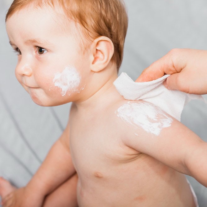 baby balms