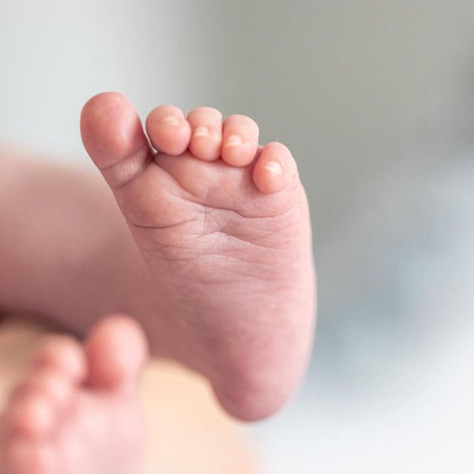 Essure reversal