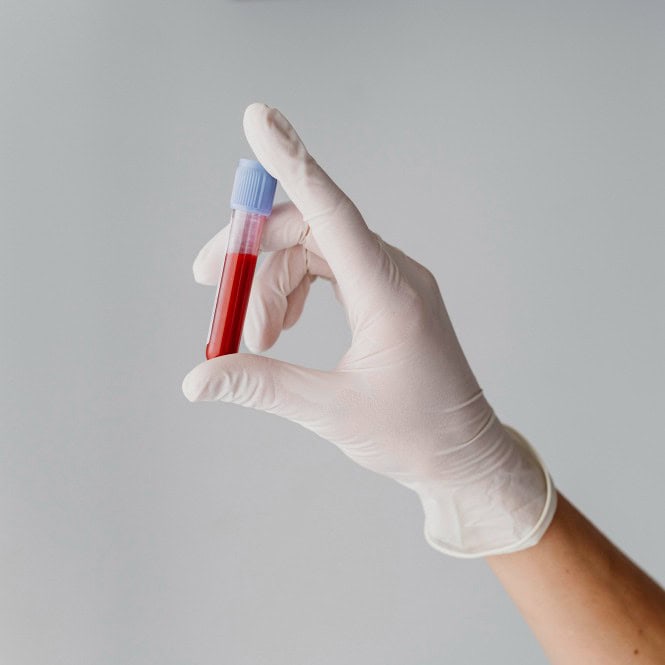 Home blood tests