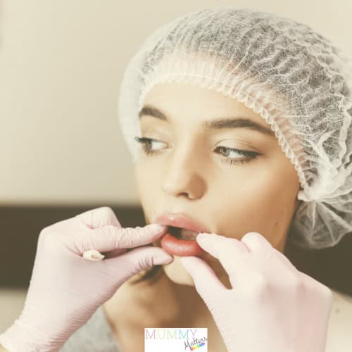 Lip Reduction Surgery