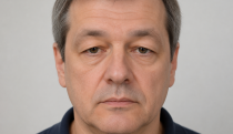 Mężczyzna z widocznymi oznakami starzenia i problemami skórnymi na twarzy.