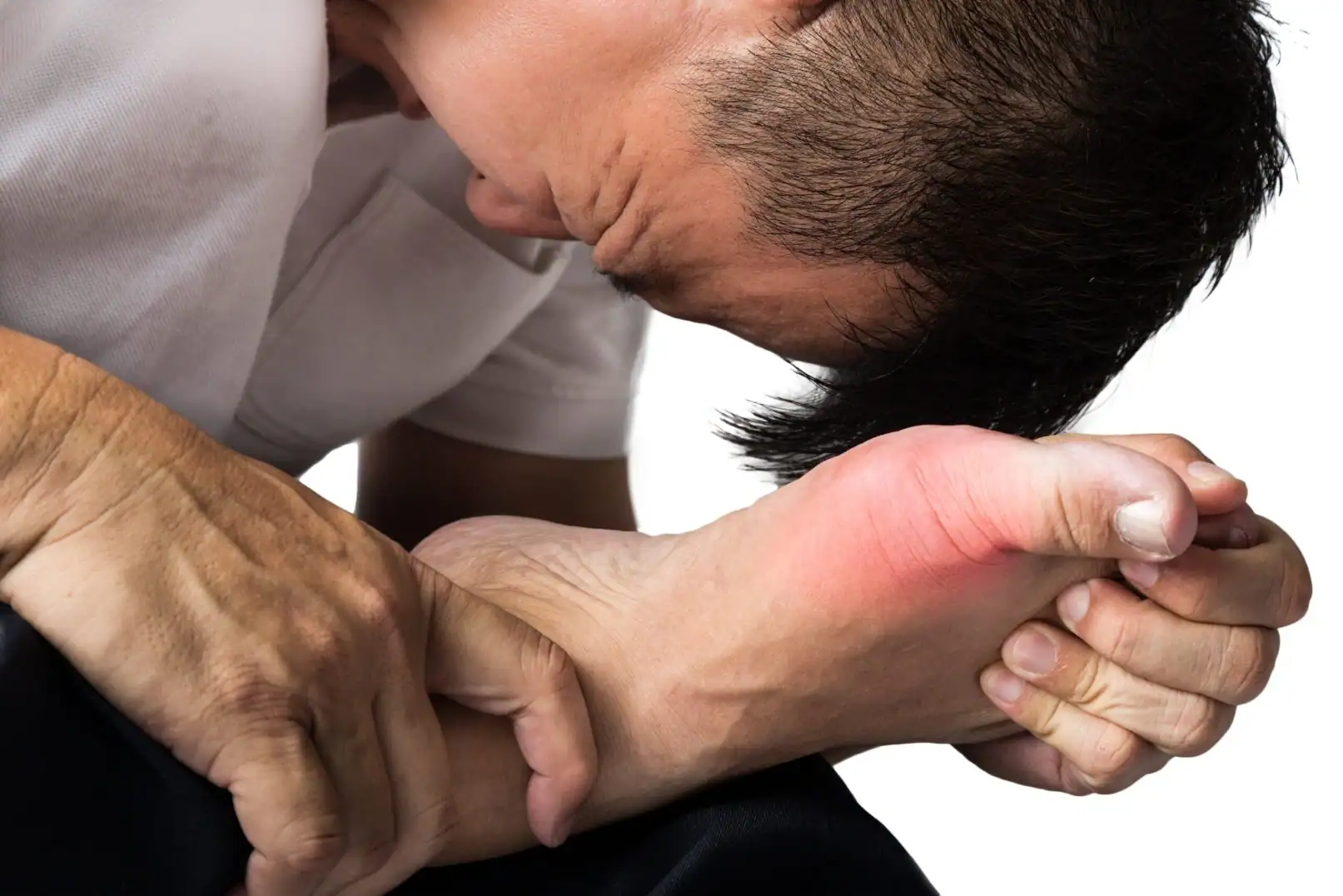 gout clinical trial