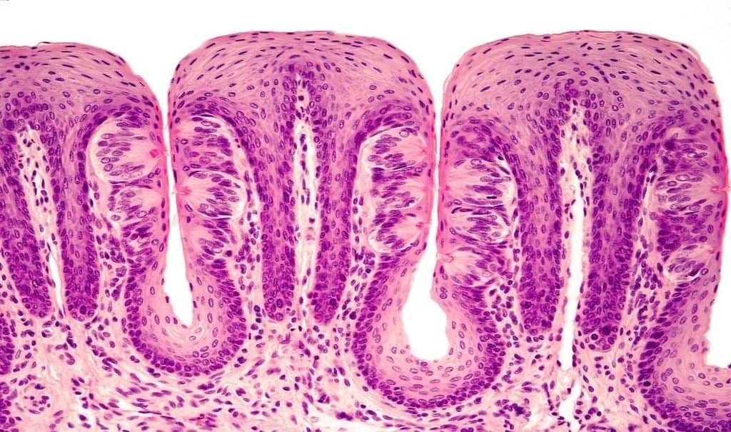 Microscopic view of intestinal tissue showing villi and cellular structure.