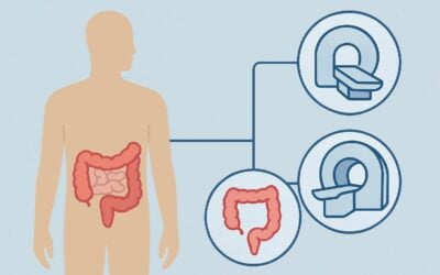 Which Imaging Is Best for Elevated-Risk Colorectal Cancer Screening in Patients 45-75?