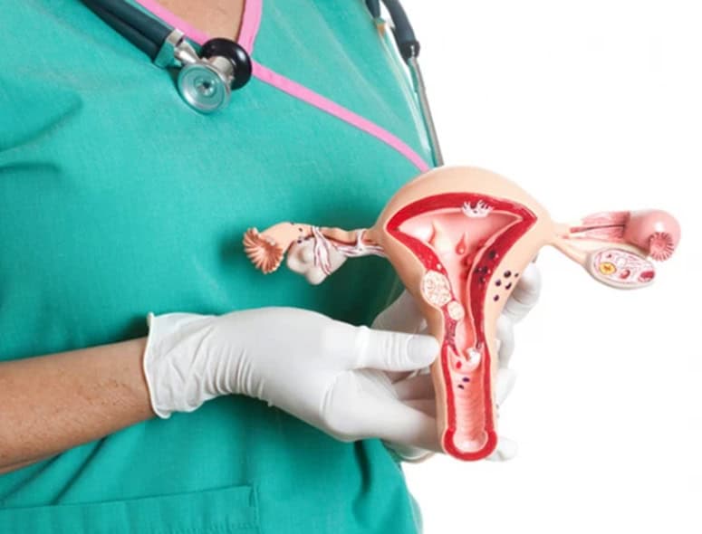 Medical professional holding a uterus model for reproductive health education.