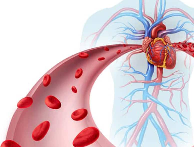 Illustration of upper GI bleeding showing blood vessels and bleeding in the digestive tract.