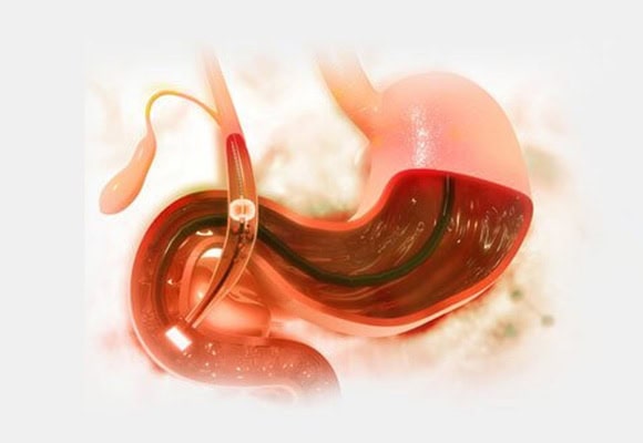 Medical illustration of the stomach and digestive system for gastroenterology.
