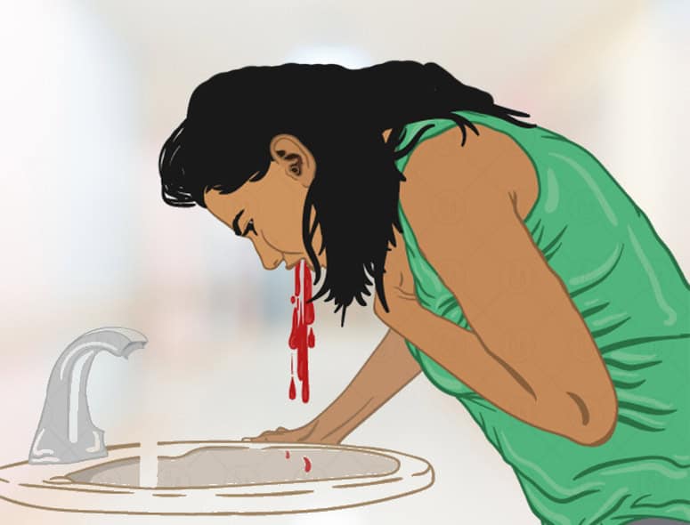 Woman experiencing upper GI bleeding, holding her stomach in pain.