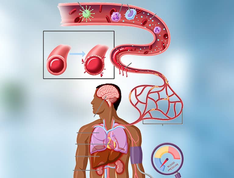 Illustration of appendix inflammation and its effects on the body.