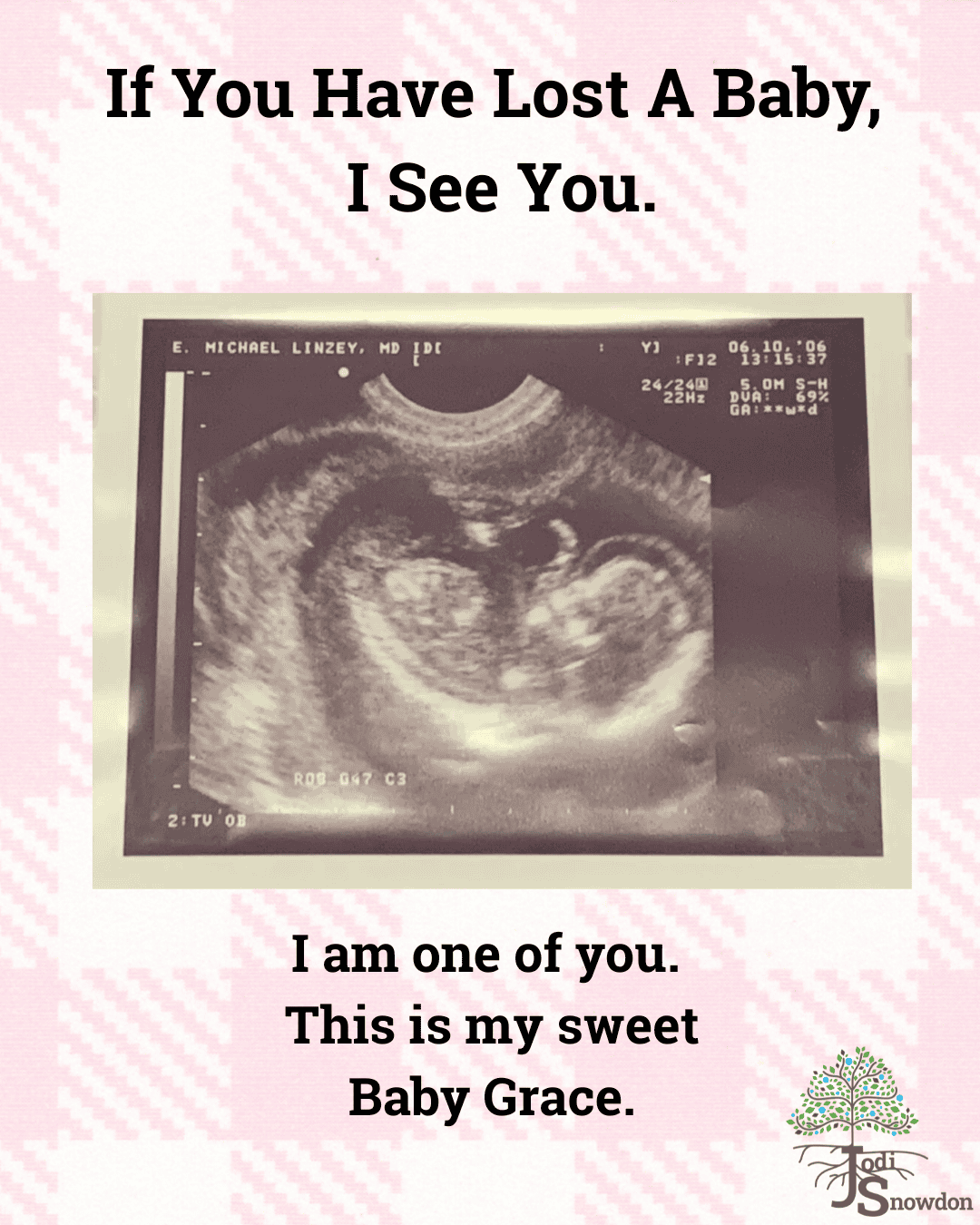 Ultrasound scan of baby Grace for pregnancy loss support.