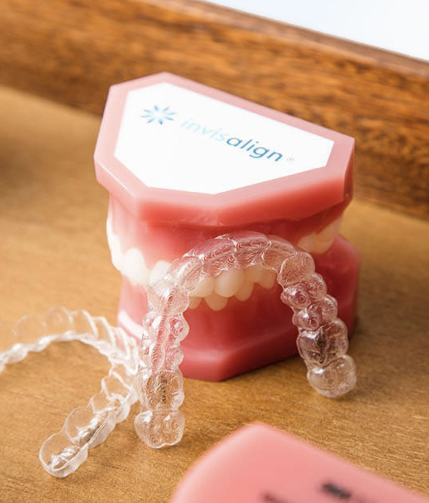 Patient holding an Invisalign clear aligner
