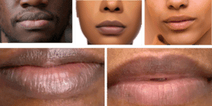 Lip