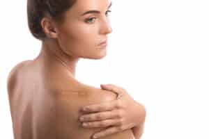 WomanShoulderScarStockPhoto