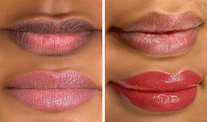 lip-neutralization