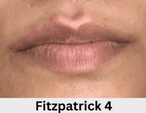 Lip Neutralization artist Atlanta