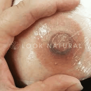 Actual 3-D nipple and areola tattoo result on healed skin showing hyper-realistic medical micropigmentation