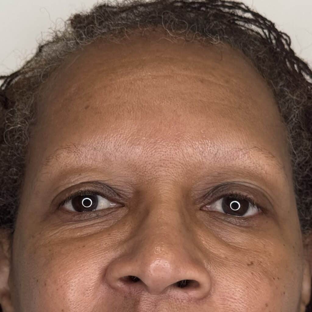 IMG_8699+2 | Look Natural Atlanta - Micropigmentation Clinic Before Thyroid Hair Loss
