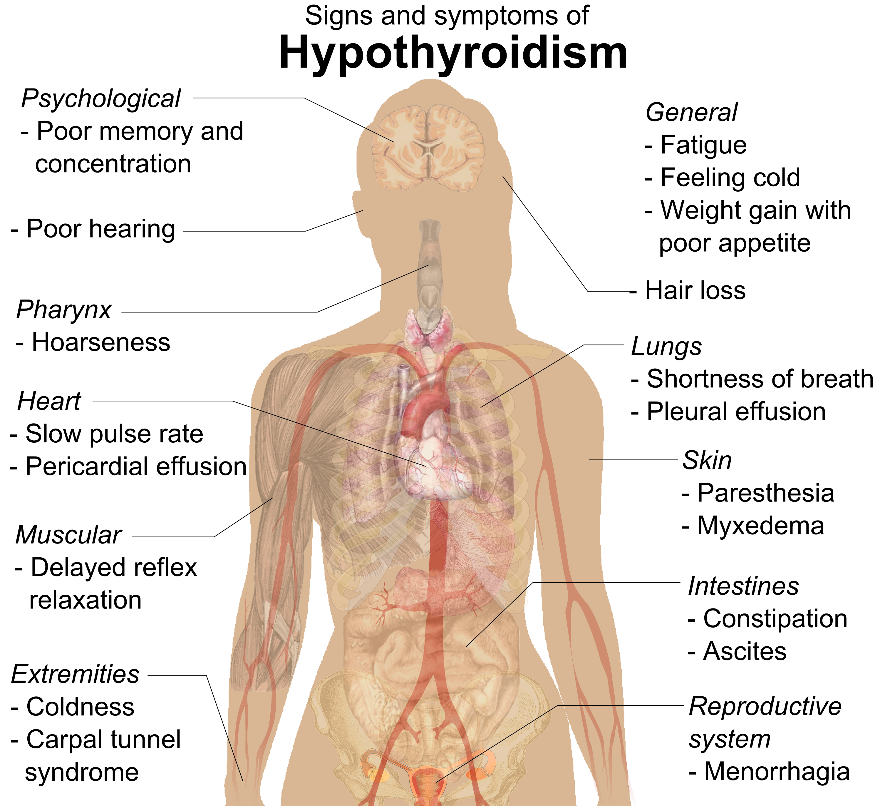 hypothyroid