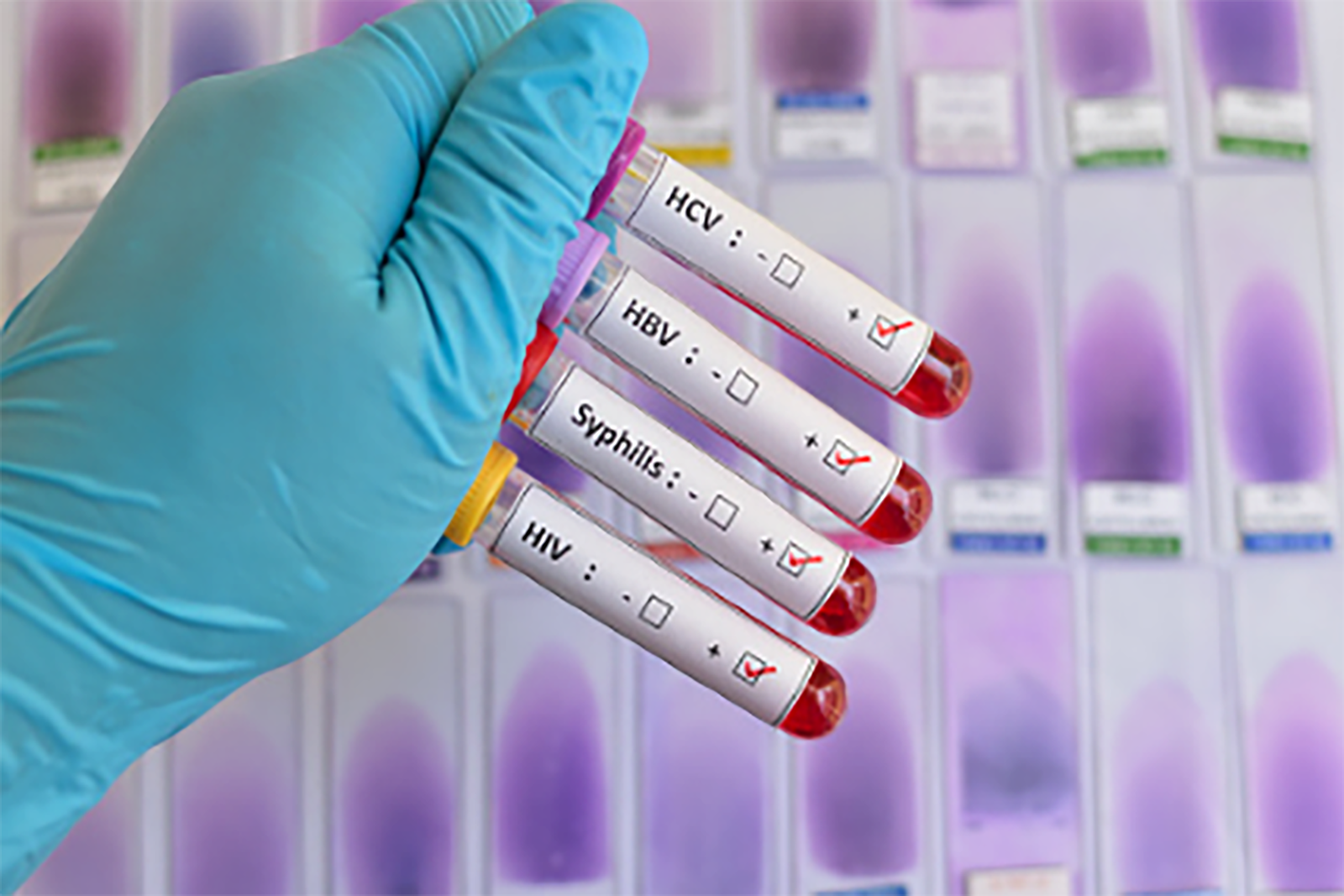 std-screenings
