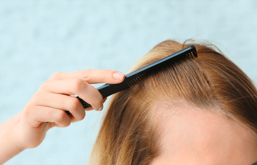 PRP, Platelet-Rich Plasma, Hair Growth
