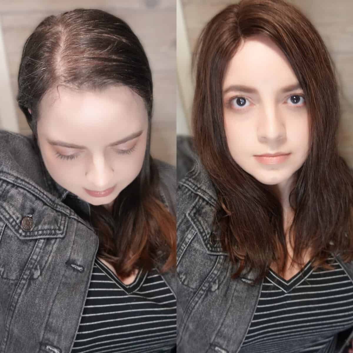 A before and after image side by side of a woman with hair loss with and without a hairtopper.