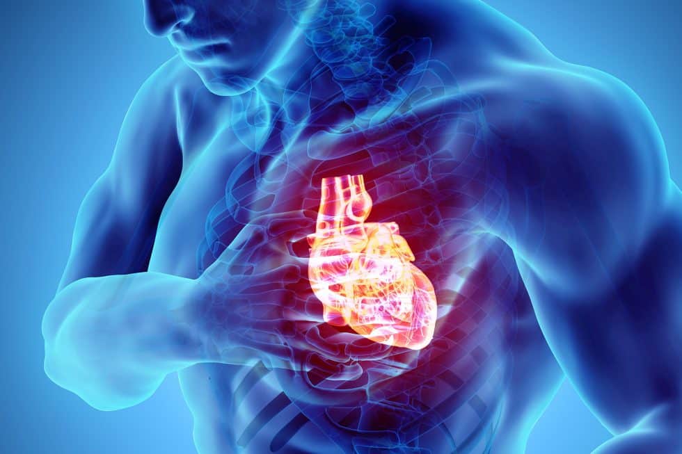 High Ozone Levels Up Cardiac Arrest Risk: Study