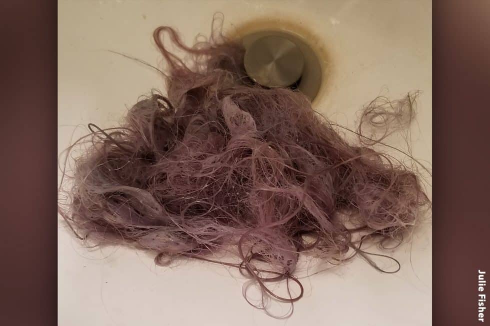 Losing Your Hair Because of Pandemic Stress?